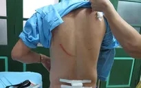 Nhà báo bị côn đồ truy sát giữa đường ở Thái Nguyên