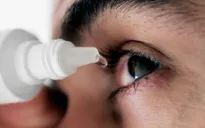 Đau mắt đỏ: Nguyên nhân và cách phòng bệnh