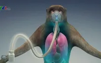 Thử nghiệm vaccine mới điều trị Ebola