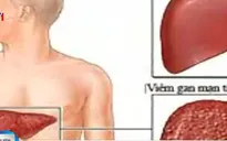 Khó tránh khỏi nhiễm bệnh viêm gan C khi xăm hình