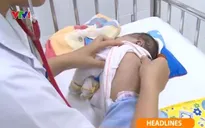 Gia tăng bệnh nhi mắc ho gà
