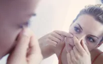 Bí kíp phòng ngừa mụn trứng cá