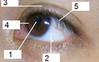 Nhìn mắt bắt bệnh - Bật mí bệnh tiềm ẩn qua mắt