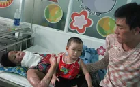 Di chứng kinh hoàng của hai mẹ con bị bỏng sau vụ cháy nhà