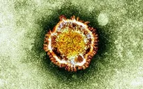 Trung Quốc ghi nhận trường hợp đầu tiên nhiễm MERS