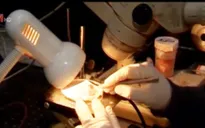 Dùng tia laser chữa lành vết thương
