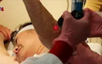 'Em bé napalm’ Kim Phúc được điều trị vết thương chiến tranh