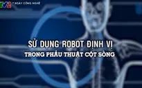 Ứng dụng robot hỗ trợ phẫu thuật