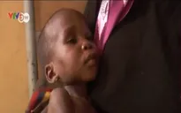 Nhiều trẻ thoát khỏi tay Boko Haram bị suy dinh dưỡng trầm trọng