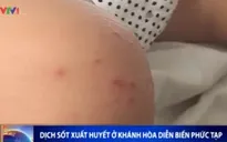 Khánh Hòa: Bệnh sốt xuất huyết diễn biến phức tạp