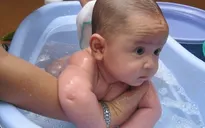 Phòng tránh rôm sảy cho trẻ trong mùa nắng nóng