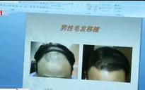 Phẫu thuật thẩm mỹ - Món quà vô giá với nam giới Hàn Quốc