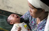 Thiếu sữa mẹ, bé 2 tháng tuổi chỉ ăn nước cháo để sống