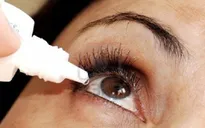 Lưu ý khi xử trí chấn thương mắt
