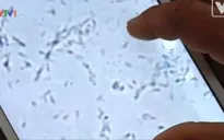 Isperm: Dụng cụ kiểm tra tinh trùng bằng iPad
