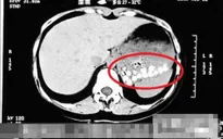 Trân châu trong trà sữa Trung Quốc chứa thành phần đáng ngờ
