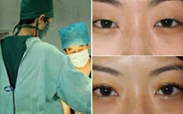Phụ nữ Trung Quốc không ngại "đổ" tiền cho phẫu thuật thẩm mỹ
