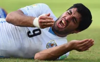 Ngứa răng, Luis Suarez lại cắn?