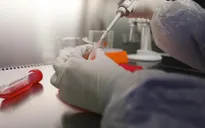 Bước tiến mới trong phát triển virus phòng ngừa MERS