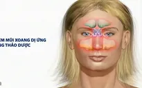 7 lưu ý đối với bệnh viêm mũi xoang dị ứng