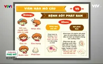 Bệnh viêm não mô cầu có thể gây tử vong hoặc di chứng nghiêm trọng