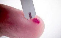 Tự xét nghiệm HIV cho kết quả tại chỗ chỉ trong 20 phút