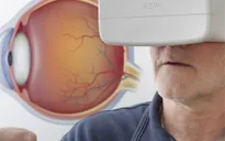 Biến điện thoại thành thiết bị xét nghiệm tăng nhãn áp