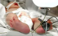 Dấu hiệu viêm màng não mô cầu