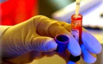 Tỷ lệ người trưởng thành nhiễm HIV tăng cao trong 5 năm qua