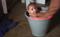 Mỹ khuyến cáo thai phụ không đến 14 nước có virus Zika