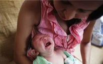 Mỹ: 14 ca nghi nhiễm virus Zika qua đường tình dục