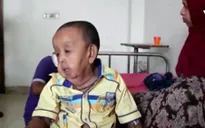Bangladesh: Điều trị miễn phí cho em bé 4 tuổi như ông lão