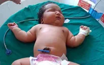 Bé gái sơ sinh nặng 6.8 kg chào đời ở Ấn Độ
