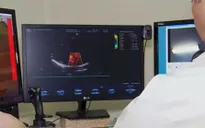Robot cho phép bác sỹ siêu âm từ xa cho bệnh nhân