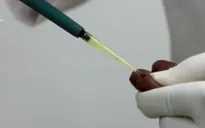 Phòng khám bệnh tư miễn phí công nghệ cao đầu tiên tại Ấn Độ