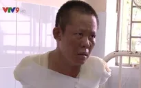 Báo động gia tăng bỏng điện tại TP.HCM