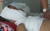 Bé trai bị bỏng nặng do ngậm xăng phun lửa đã qua nguy kịch