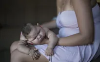 2.000 phụ nữ mang thai tại Colombia nhiễm virus Zika