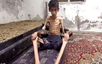 Mỹ lên tiếng về khủng hoảng nhân đạo tại Madaya