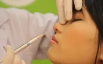 Cảnh báo nguy hiểm khi tiêm chất làm đầy tại các cơ sở “chui”