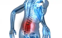 Điều trị hiệu quả chứng đau lưng bằng y học cổ truyền