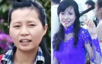 Cô gái sứt môi xinh đẹp bất ngờ tại Change Life - Thay đổi cuộc sống mùa 2