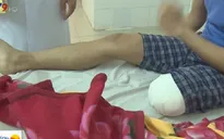 Điều tra nguyên nhân vụ nhân viên y tế tự tháo khớp chân