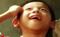 Chất da cam/dioxin hiện hữu thế nào tại Việt Nam?