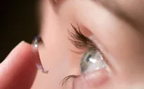 Đeo kính áp tròng cứng có điều trị được cận thị?