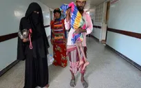 Hơn 14 triệu người Yemen bị thiếu lương thực trầm trọng