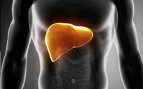 Những bài thuốc đông y trị gan nhiễm mỡ hiệu quả