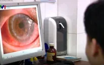 Ghép thành công giác mạc do bác sĩ hiến tặng