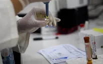 Thử nghiệm tích cực, thế giới sắp có vaccine ngừa virus Zika?