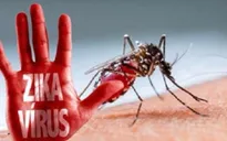 Cách xác định thai nhi mắc chứng đầu nhỏ do virus Zika
